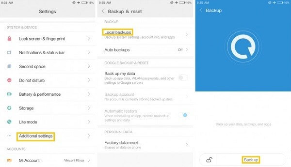 Xiaomi local backups